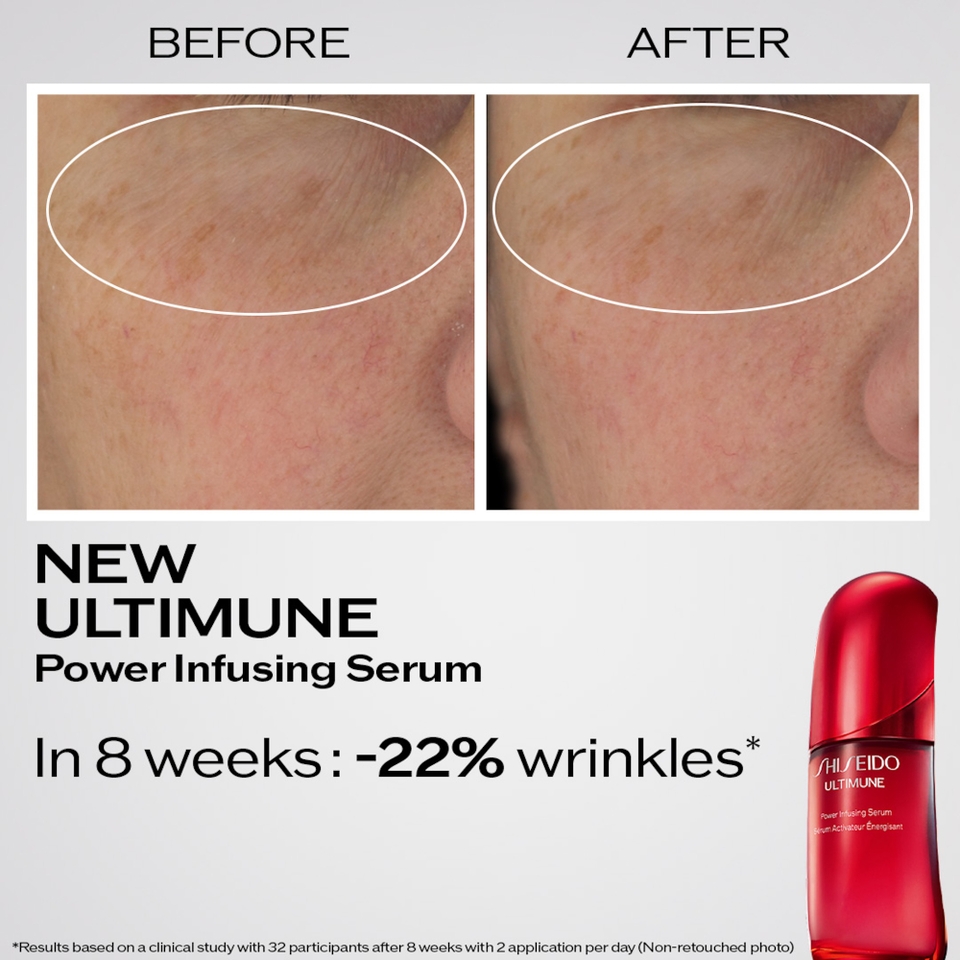 Shiseido Ultimune Power Infusing Serum ไอคอนิกเซรั่ม สูตรใหม่