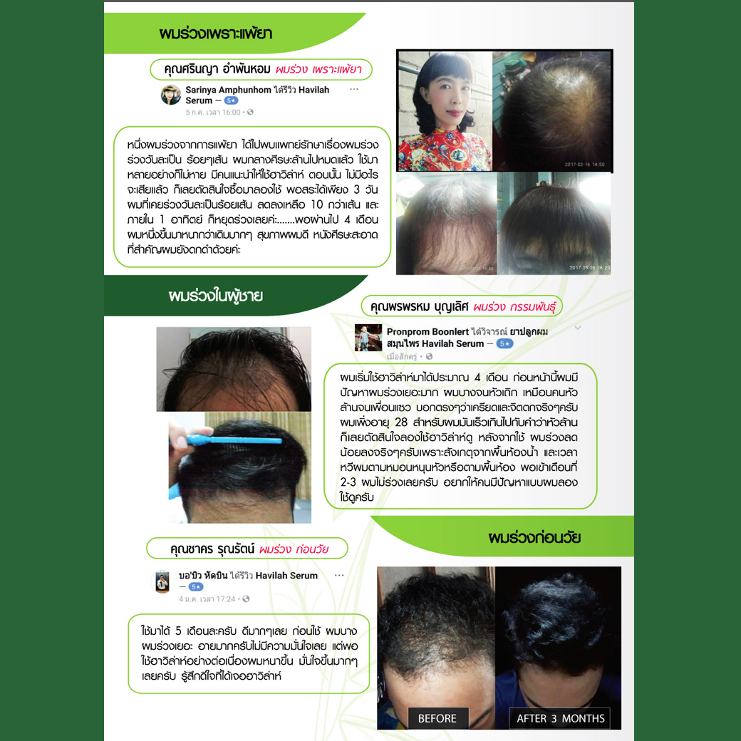 Havilah โทนิคปลูกผม คนผมบาง ผมบางกลางหัว สมุนไพรปลูกผม เร่งผมยาว