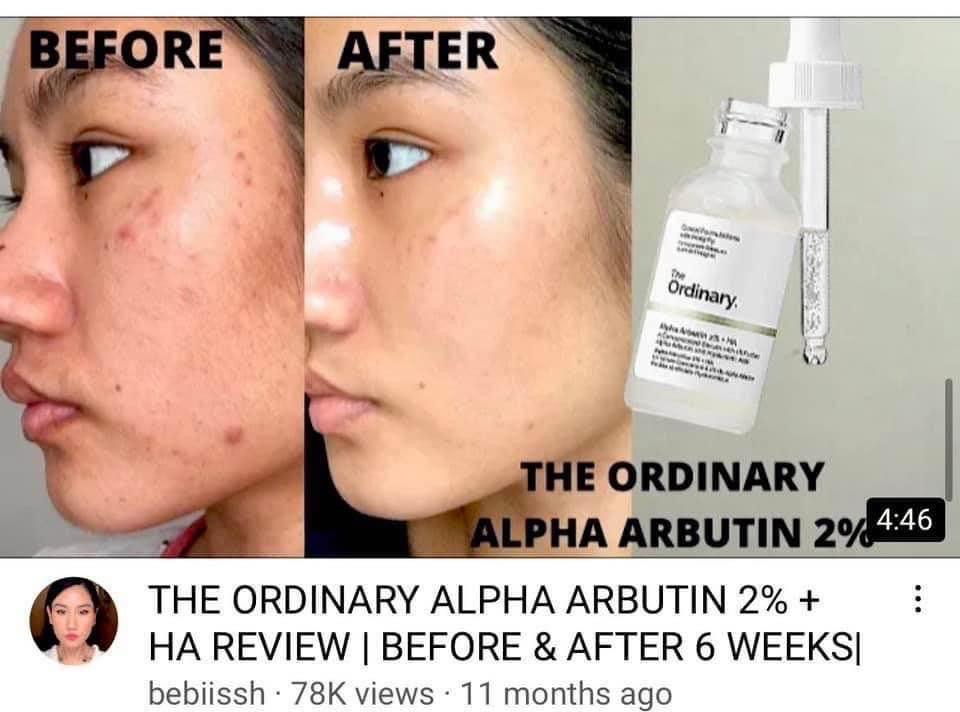 The Ordinary Alpha Arbutin 2 % + HA Serum 30ml. เซรั่มลดเลือนจุดด่างดำ