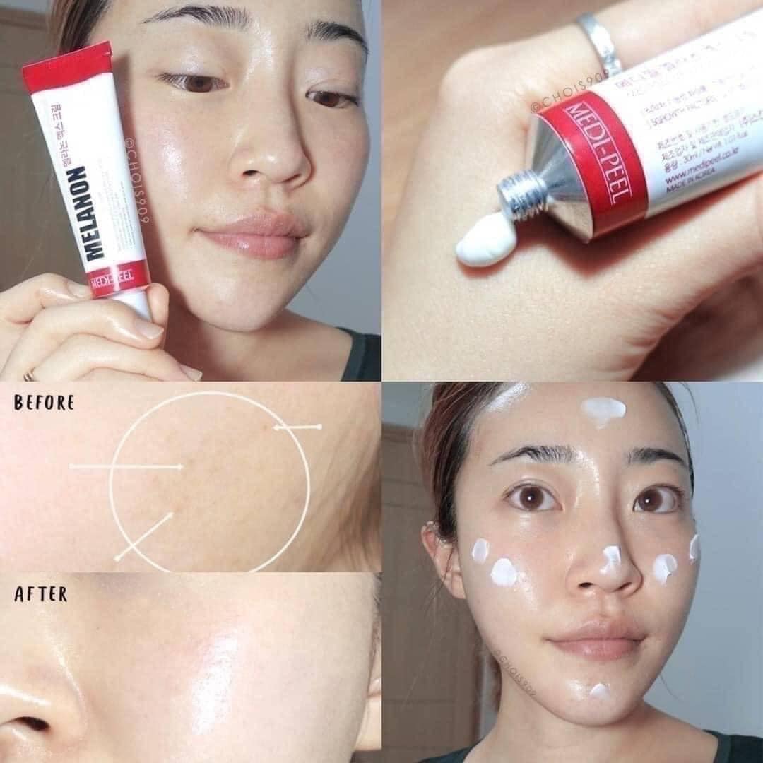 Medi-Peel Melanon X Cream 30ml. ครีมบำรุงผิว ช่วยลดเลือนฝ้า กระ และจุดด่างดำ