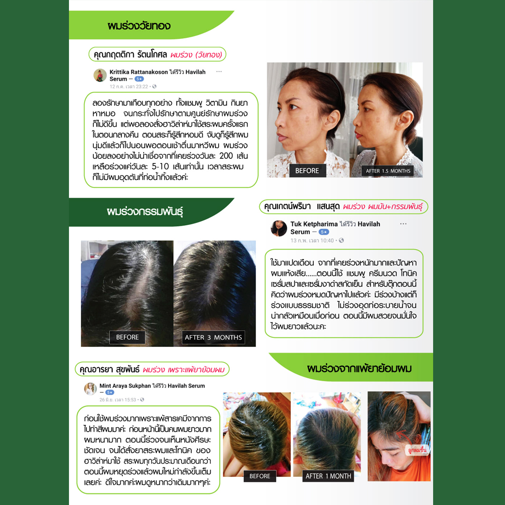 Havilah โทนิคปลูกผม คนผมบาง ผมบางกลางหัว สมุนไพรปลูกผม เร่งผมยาว