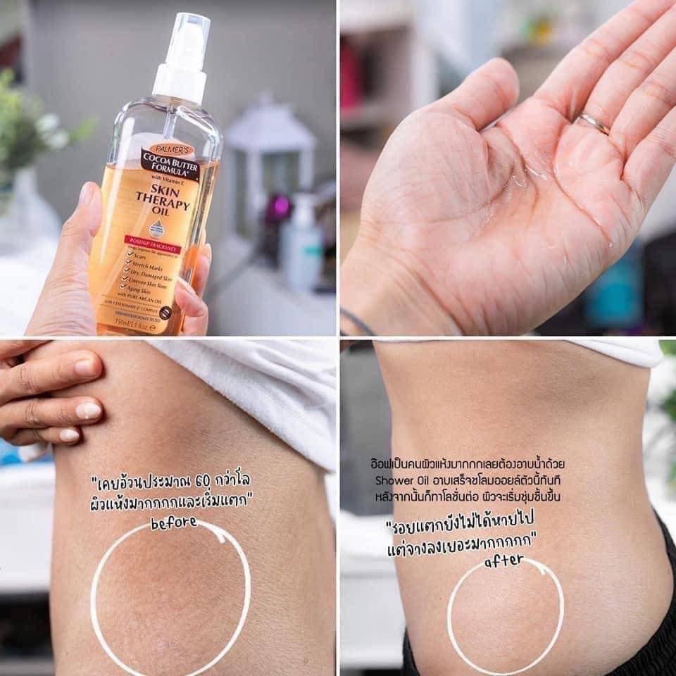 Palmer's Cocoa Butter Formula Skin Therapy Oil 150ml. ออยล์บำรุงผิว