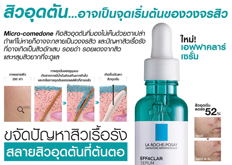 La Roche Posay Effaclar Serum 30ml. เซรั่มสลายสิวอุดตัน