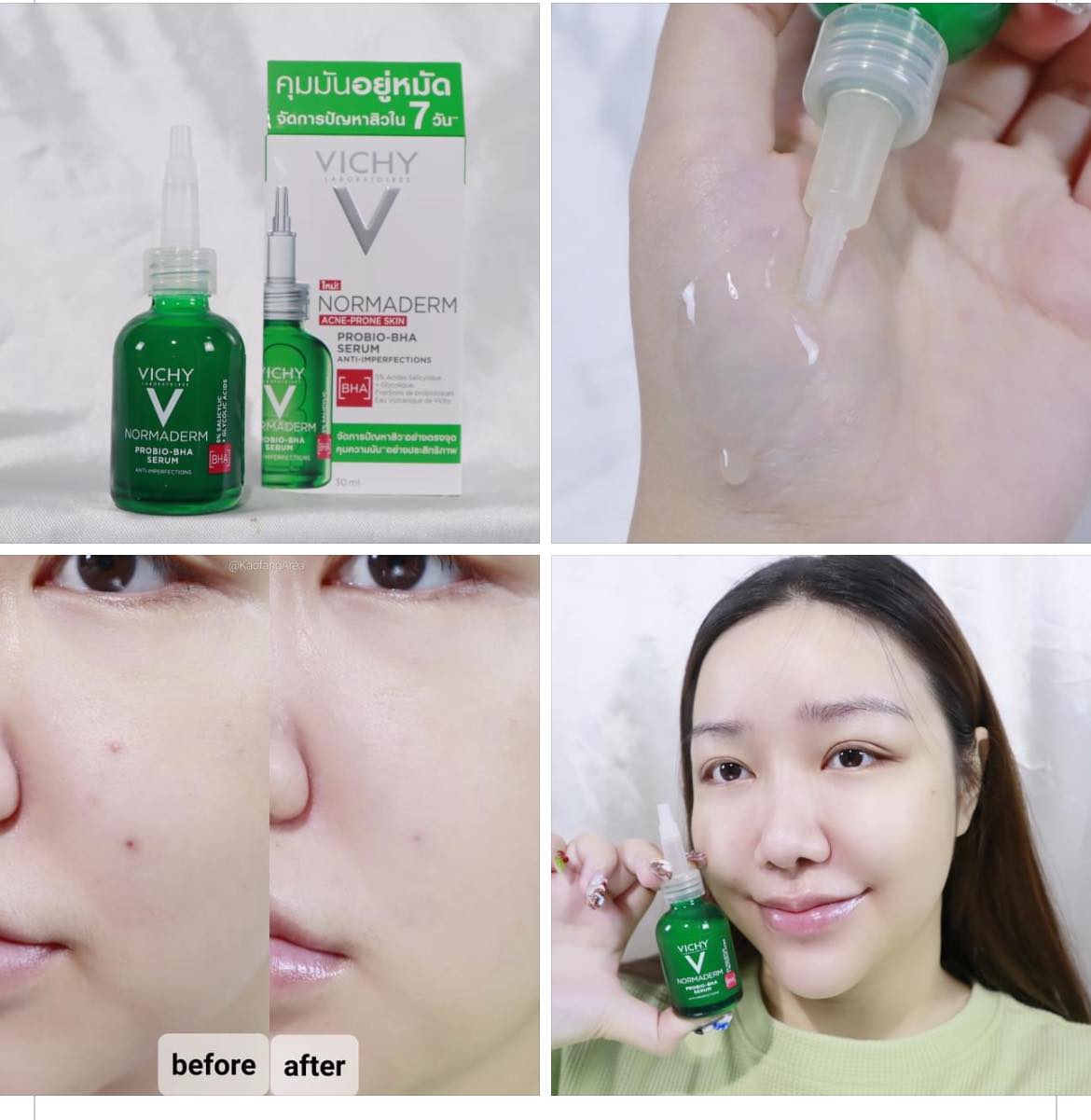 Vichy Normaderm Pro-Bio BHA Serum 30ml. เซรั่มจัดการปัญหาสิว คุมความมันส่วนเกิน