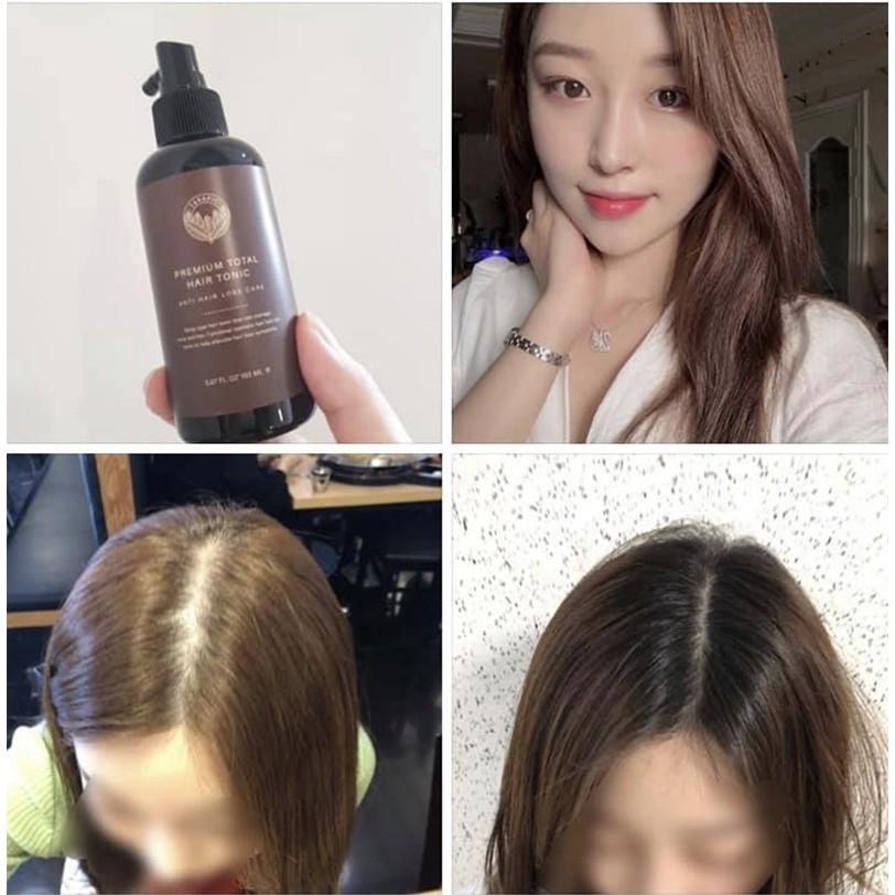 Terapic Premium Total Hair Tonic 150ml. เซรั่มสเปรย์จากเกาหลี แก้ผมร่วง ผมบาง