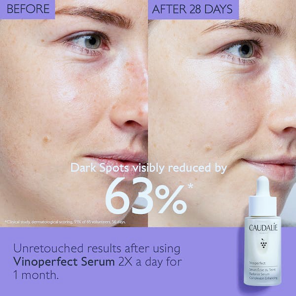 Caudalie Vinoperfect Serum 30ml. เซรั่มลดเลือนจุดด่างดำ (1ขวด)