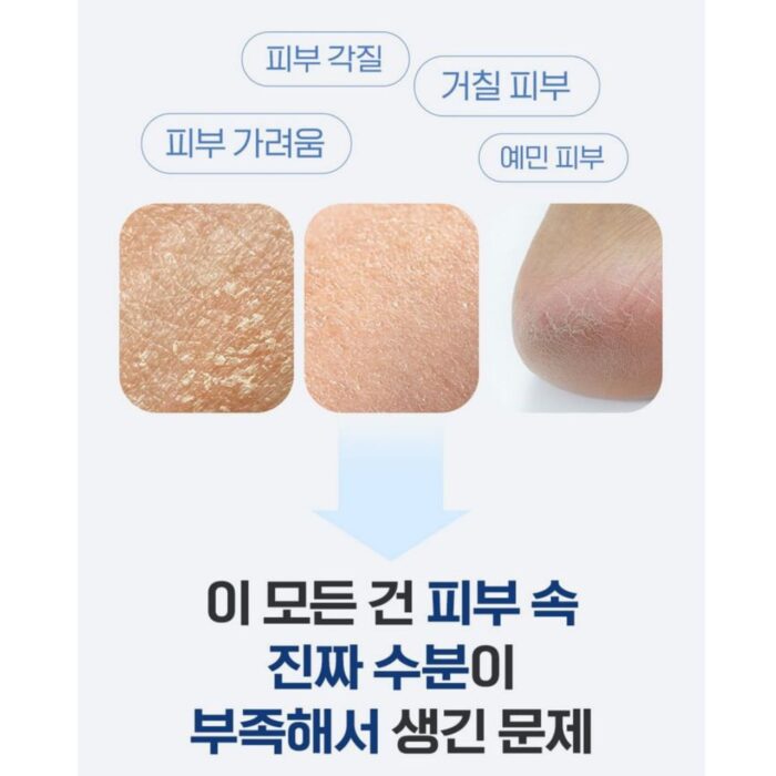 Medipeel Hyaluron Layer Mooltox Body Lotion 400ml. โลชั่นบำรุงผิวตัวฮิตจากเกาหลี