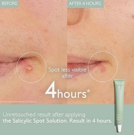 Caudalie Vinopure Stop Boutons Salicylic Spot Treatment 15ml. เจลแต้มสิว